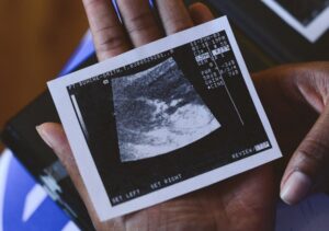 Black woman's hand holding sonogram picture
